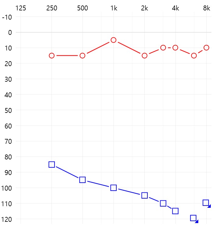 보청기 전문업체 나눔보청기 편측난청 B고객청력도