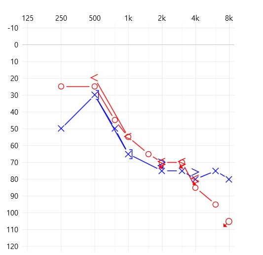 보청기 전문업체 나눔보청기 노인성난청 청력도 1번